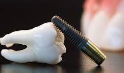 Tooth and tool